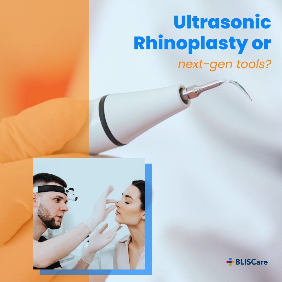Ultrasonic Rhinoplasty Or Next Gen Tools plastic surgery trends